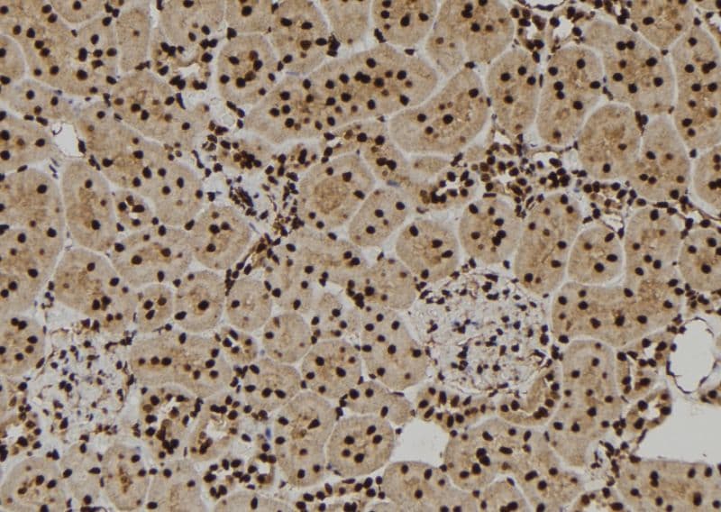 VCP Antibody