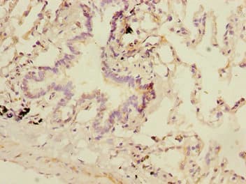 SMIF / DCP1A Antibody