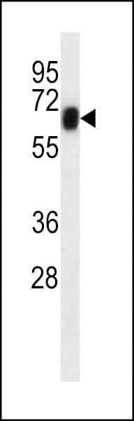 RYK Antibody (aa196-413, clone 240CT2.2.4)