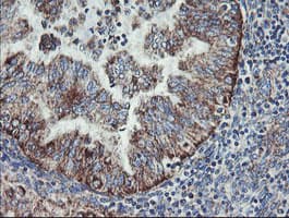 Monoclonal Mouse anti-Human C1orf151 Antibody (clone 4H7, Carrier-free, IHC, WB)
