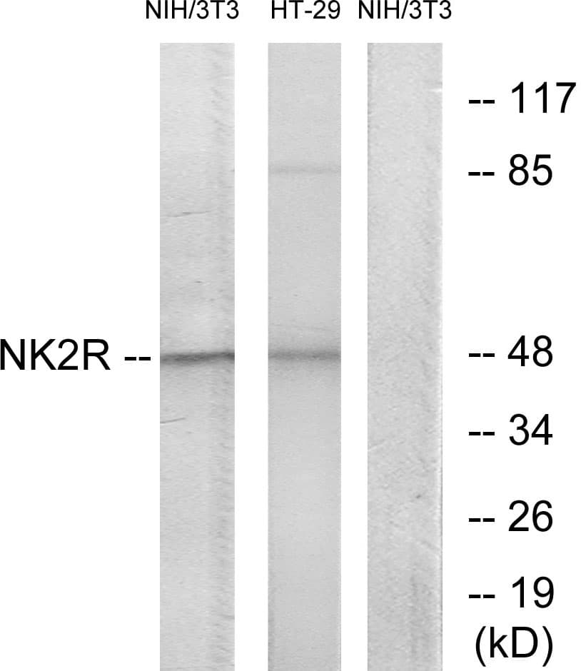 TACR2 / NK2R Antibody (aa301-350)