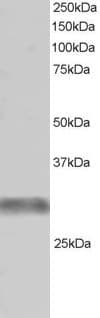 IHC-plus™ TRIM7 Antibody (aa209-221)
