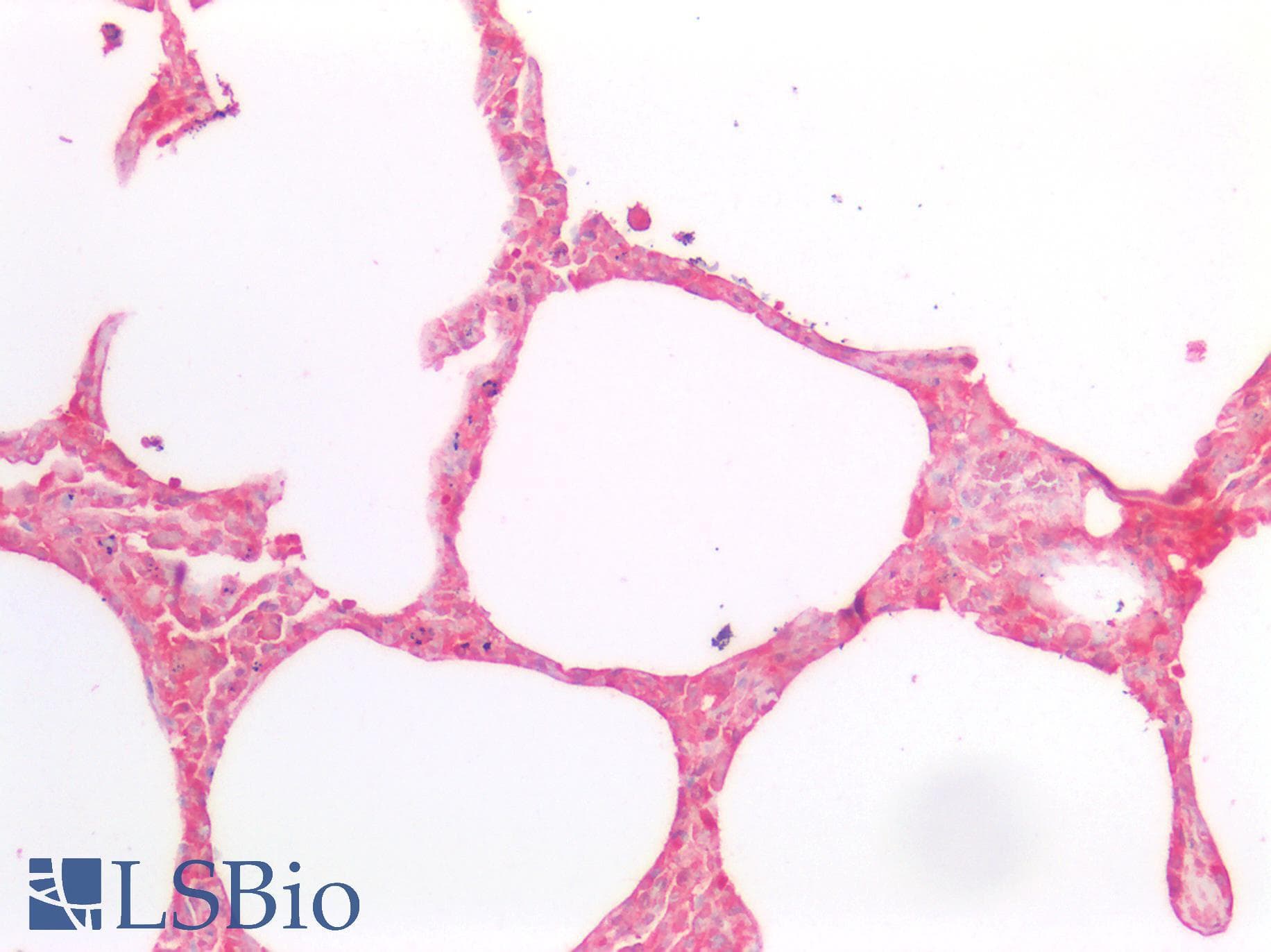 TREM2 / TREM-2 Antibody