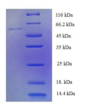 Human PDP2 Protein (Recombinant His)