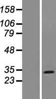 Human MOSPD3 Protein (Over-Expression Lysate Myc-DDK (Flag))