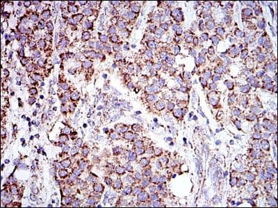 PHB / Prohibitin Antibody (clone 5H7)