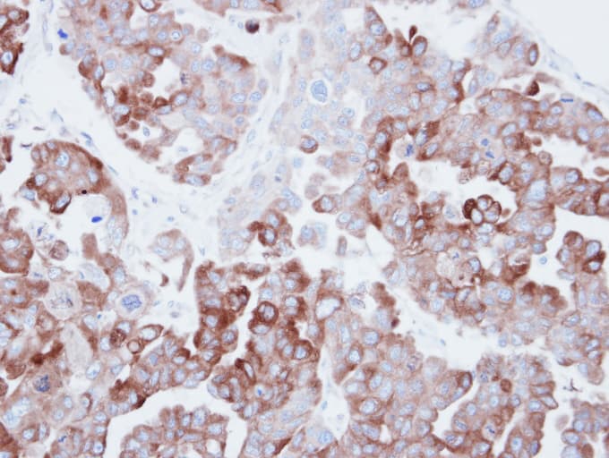 FASN / Fatty Acid Synthase Antibody (aa7-287)