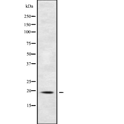 Polyclonal Rabbit anti-Human POLR2G / RPB7 Antibody (WB)