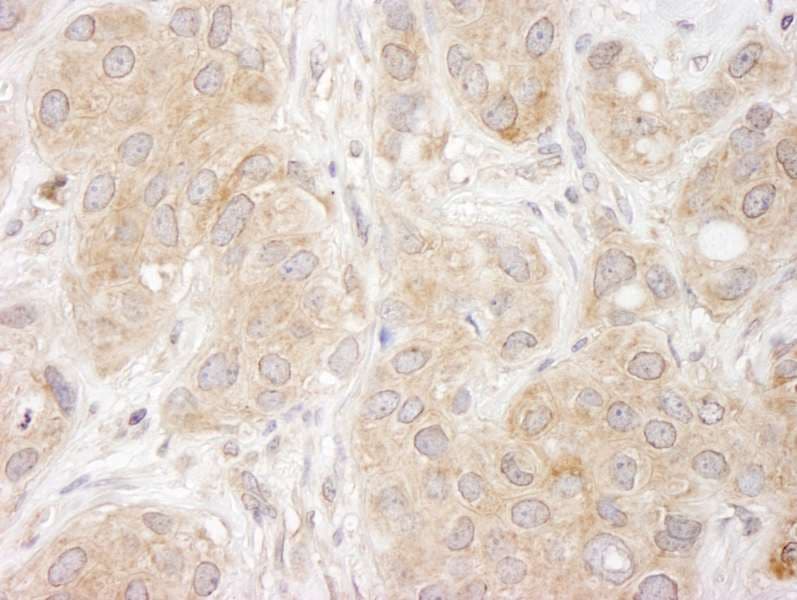 SNX1 Antibody (aa475-C-term)