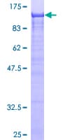 Human MAGED1 / NRAGE Protein (Recombinant GST)