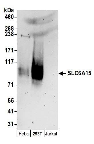 Polyclonal Rabbit anti-Human SLC6A15 / SBAT1 Antibody (aa650-700, WB)