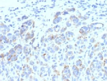 TYRP1 / gp75 Antibody (clone SPM611)