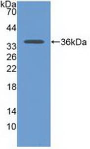 CDH17 / Cadherin 17 Antibody (aa67-351)