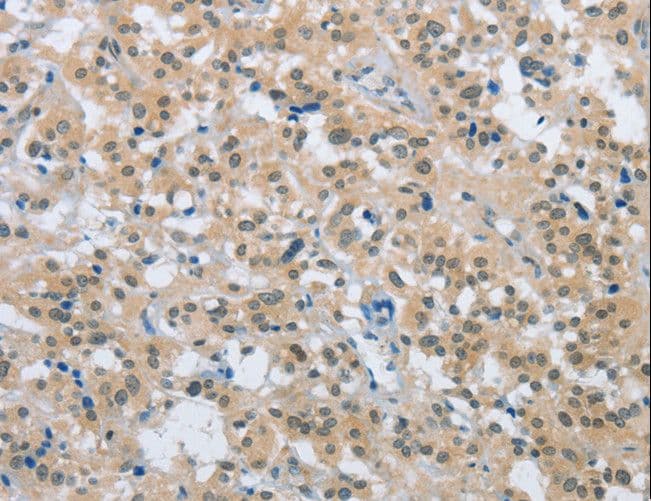 Polyclonal Rabbit anti-Human ENTPD5 / CD39L4 Antibody (IHC, WB)