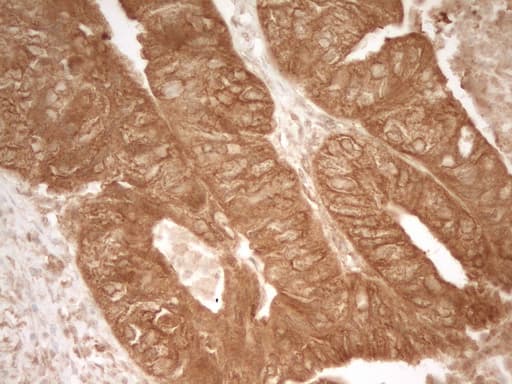 Monoclonal Mouse anti-Human PRMT5 Antibody (clone OTI4G7, aa238-499, IHC)