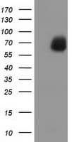 EPM2AIP1 Antibody (clone OTI1F3)