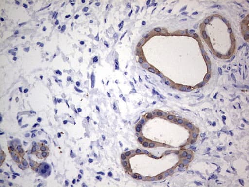 Acidic Cytokeratin Antibody (clone 8A3)