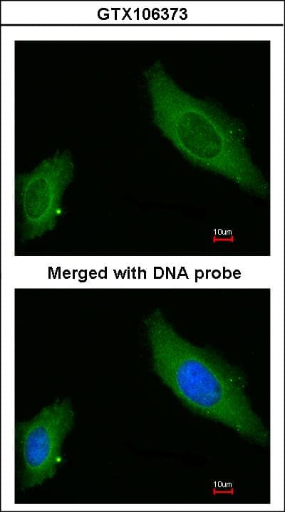 IHC-plus™ Polyclonal Rabbit anti-Human Gravin / AKAP12 Antibody (aa1719-1782, IHC, WB)