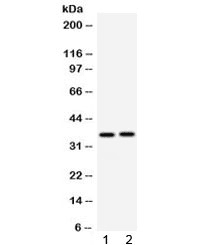 Polyclonal Rabbit anti-Mouse APOE / Apolipoprotein E Antibody (IHC, WB)