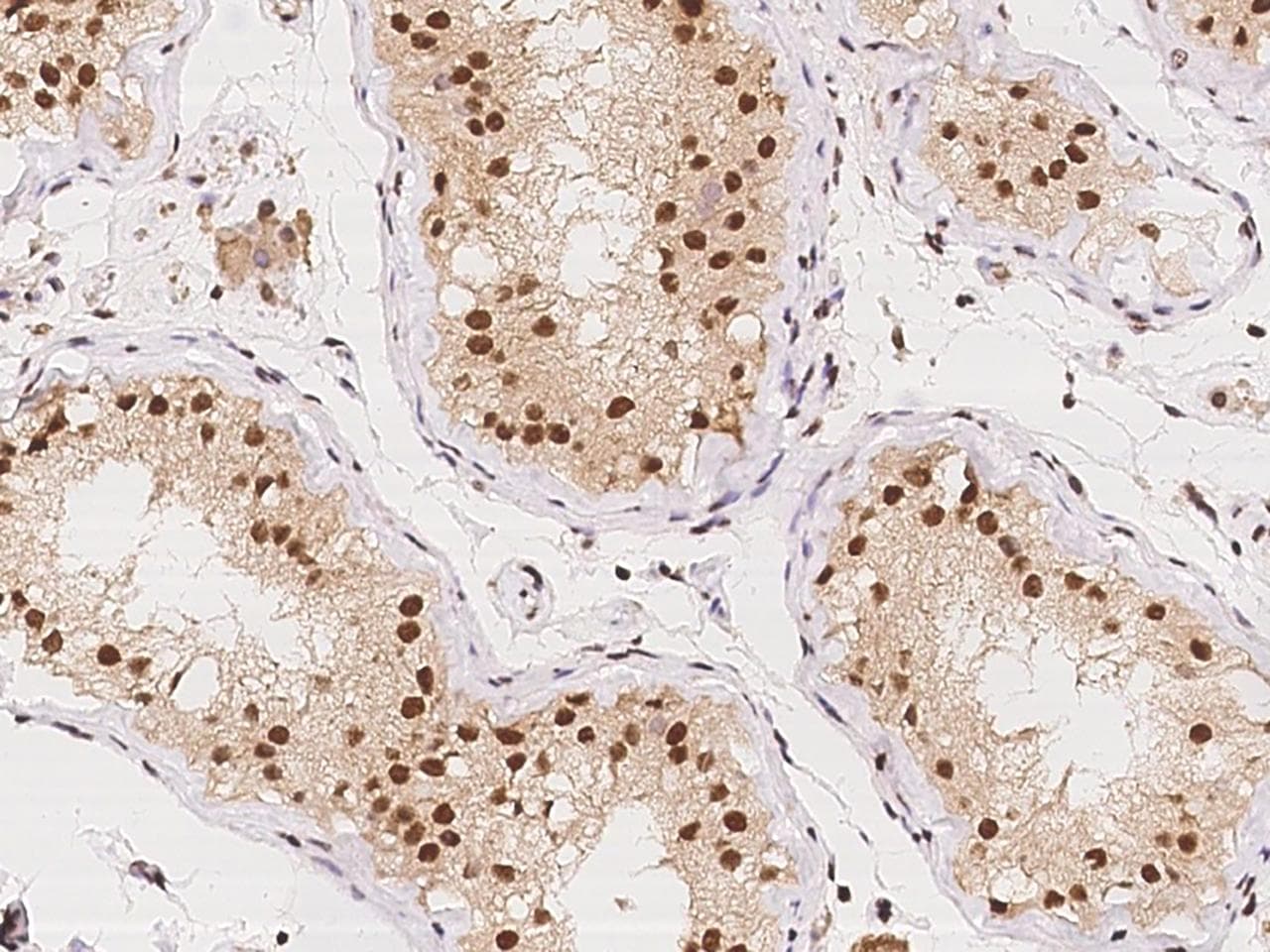 Polyclonal Rabbit anti-Human TMEM49 Antibody (IHC)