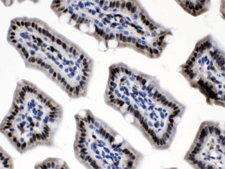 NAMPT / Visfatin Antibody