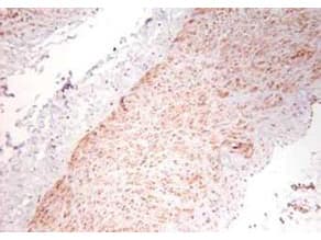 TNF Alpha Antibody