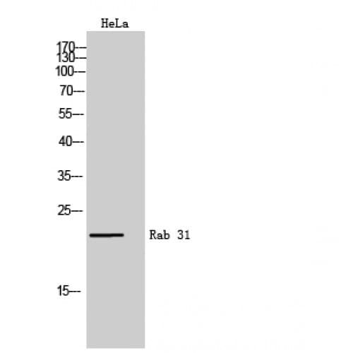 Polyclonal Rabbit anti-Human RAB31 Antibody (50-130 aa, Internal, WB)