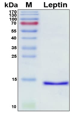 Human Leptin Protein (Recombinant His, N-Terminal)