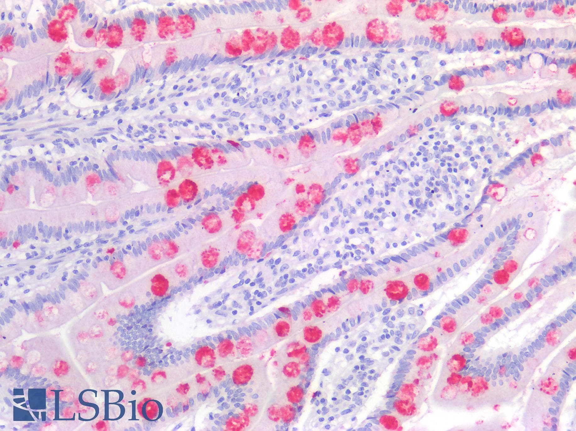 PathPlus™ TFF1 / pS2 Antibody (aa25-84)