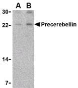 IHC-plus™ Polyclonal Rabbit anti-Human CBLN1 / Cerebellin 1 Antibody (IHC, WB)