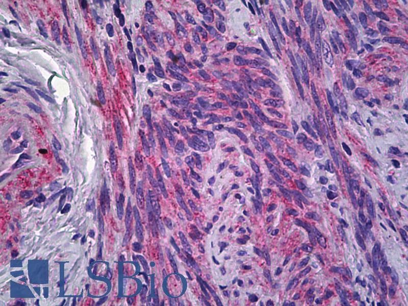 IHC-plus™ Polyclonal Rabbit anti-Human CD225 / IFITM1 Antibody (IHC, IF, WB)