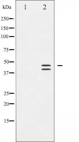 MAPK3 / ERK1 Antibody (phospho-Thr202)