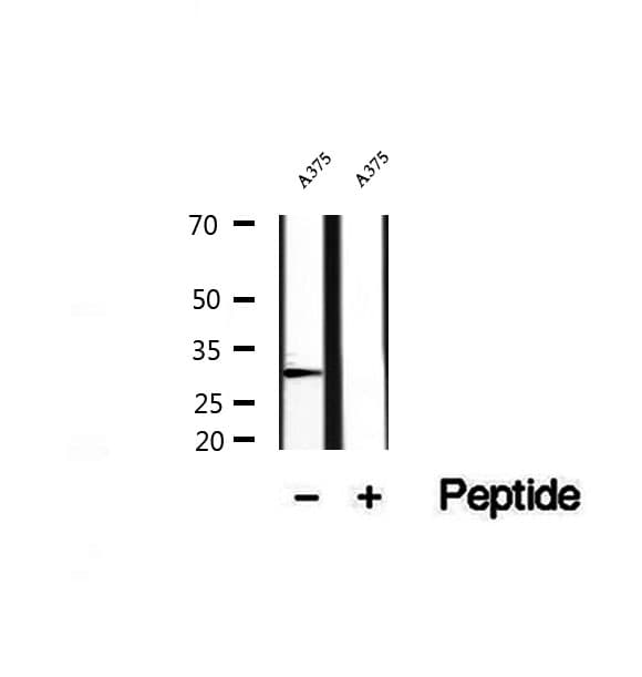 CTHRC1 Antibody (aa96-123)