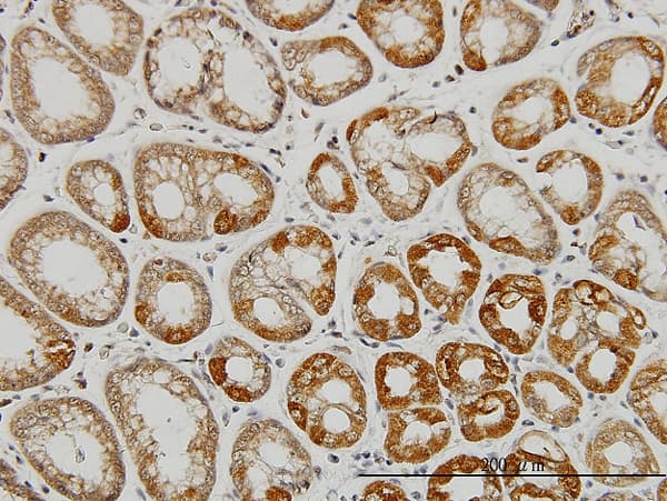 AATK / AATYK Antibody (clone 5B8)