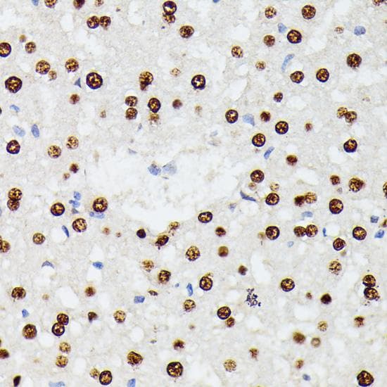 HNRNPD / AUF1 Antibody
