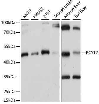 Polyclonal Rabbit anti-Human PCYT2 / ET Antibody (WB)