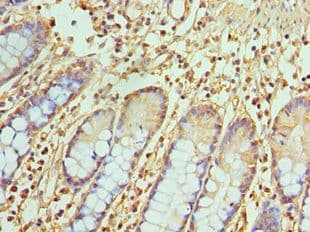 TREX1 Antibody (aa1-270)