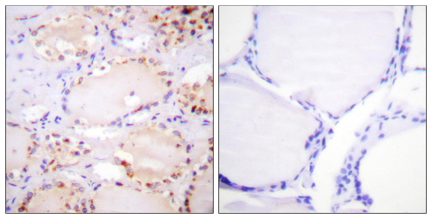 ETK / BMX Antibody (phospho-Tyr566)