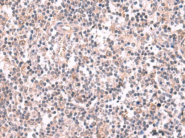 Polyclonal Rabbit anti-Human GSPT2 Antibody (IHC, WB)