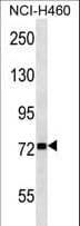 ZNF441 Antibody (aa199-228)