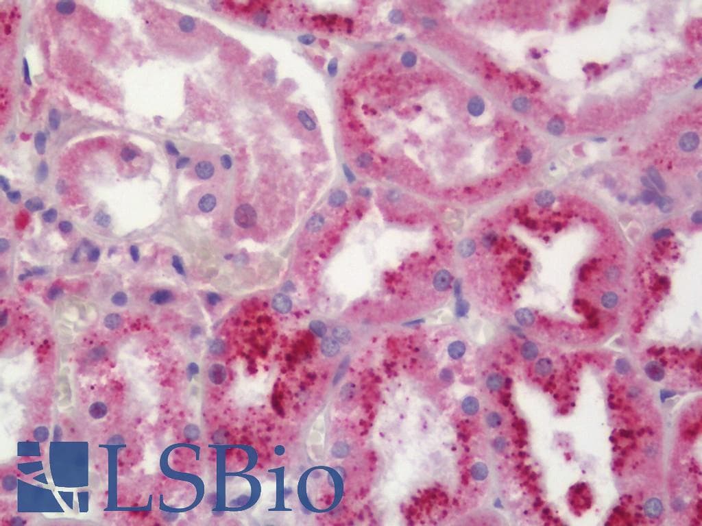 IHC-plus™ MEN1 / Menin Antibody (aa181-230)