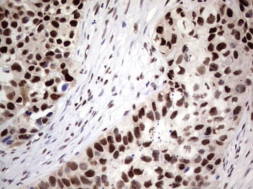 SAE1 Antibody (clone OTI3C3)
