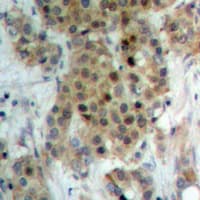 NEK9 Antibody (phospho-Thr210)