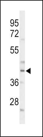 Polyclonal Rabbit anti-Human C/EBP Alpha / CEBPA Antibody (aa304-330, WB)