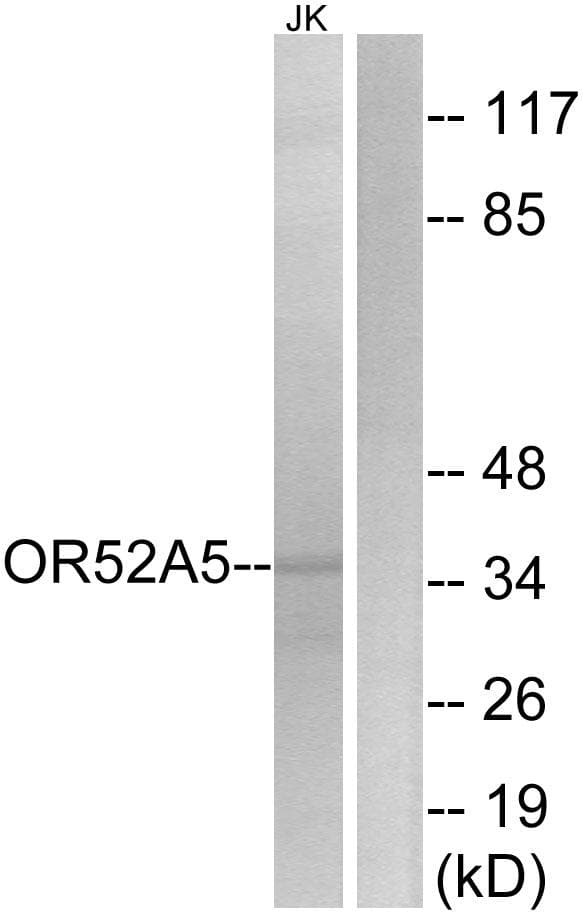 Polyclonal Rabbit anti-Human OR52A5 Antibody (WB)
