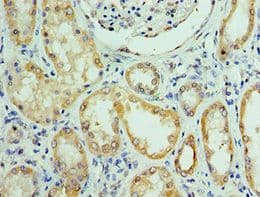 C14orf166 Antibody (aa1-244)
