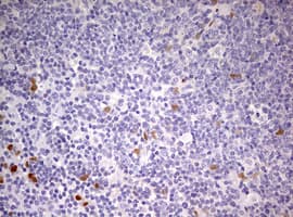 PRX-1 / PRRX1 Antibody (clone OTI2B2)
