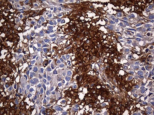 Monoclonal Mouse anti-Human CPM / Carboxypeptidase M Antibody (clone OTI4E11, aa124-423, IHC, WB)