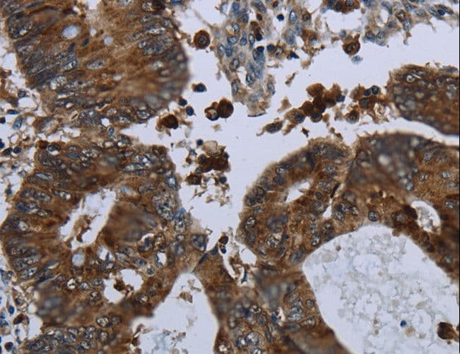 GLUL / Glutamine Synthetase Antibody