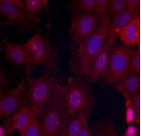 Polyclonal Rabbit anti-Human ER Alpha / Estrogen Receptor Antibody (IHC, IF, WB)